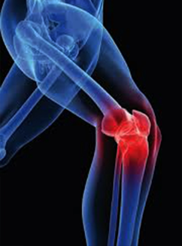 cp-knee-pain-img-1