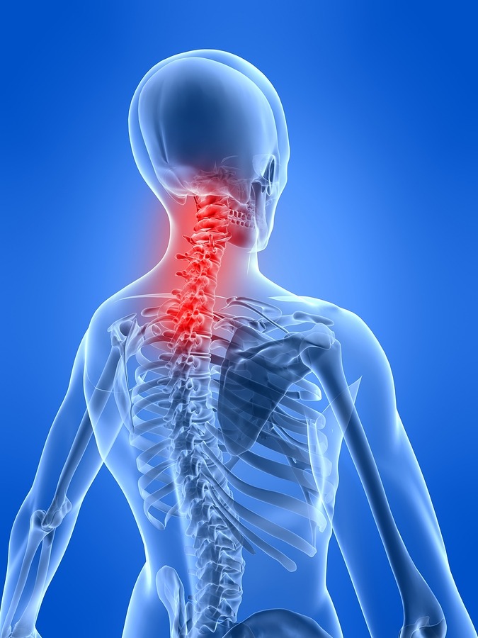 Neck Inflammation